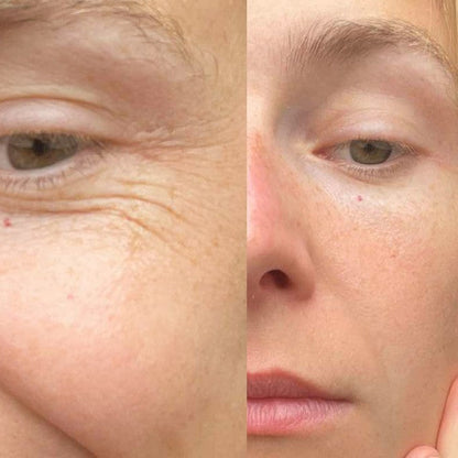 Krem Przeciwzmarszczkowy