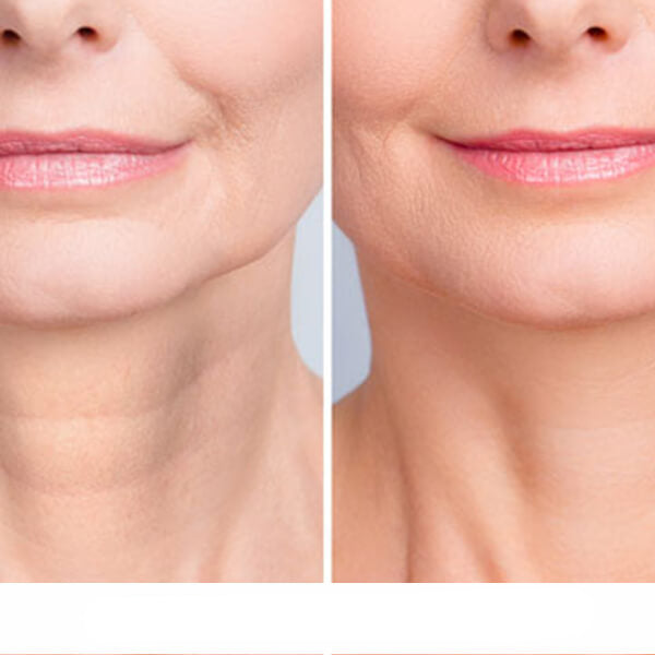 Krem Przeciwzmarszczkowy